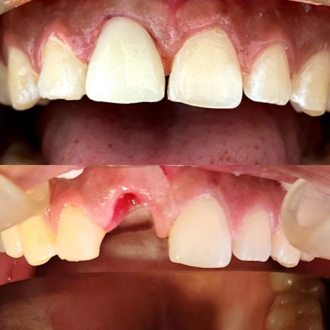 Luis Alberto Esparza-9