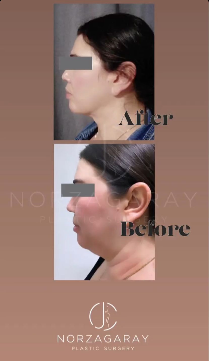 Juan Carlos Norzagaray-22