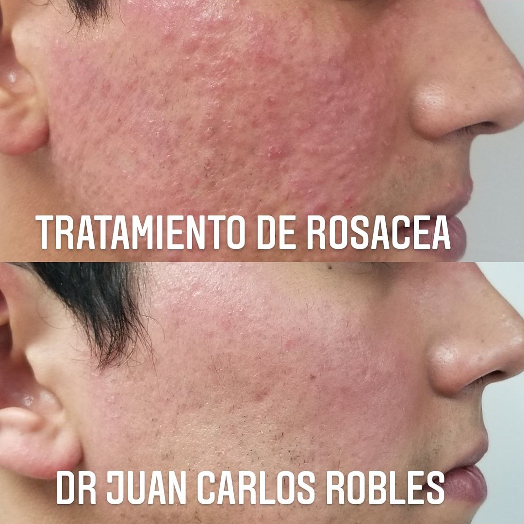 Juan Carlos Robles Méndez-9