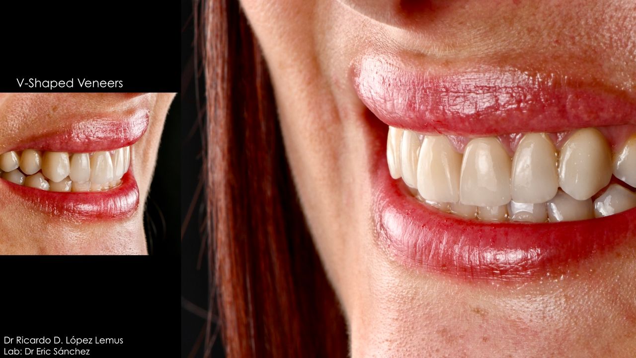 Ricardo López Lemus-54