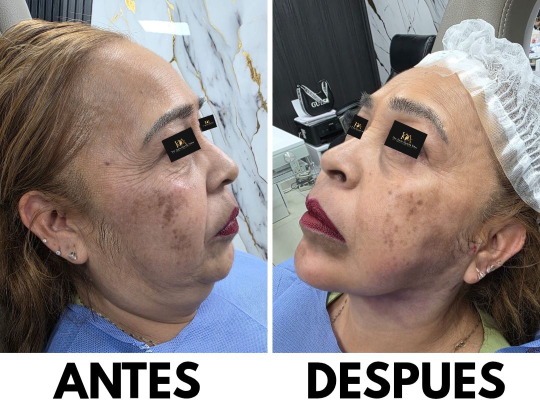 Karla Alamilla Yañez-2