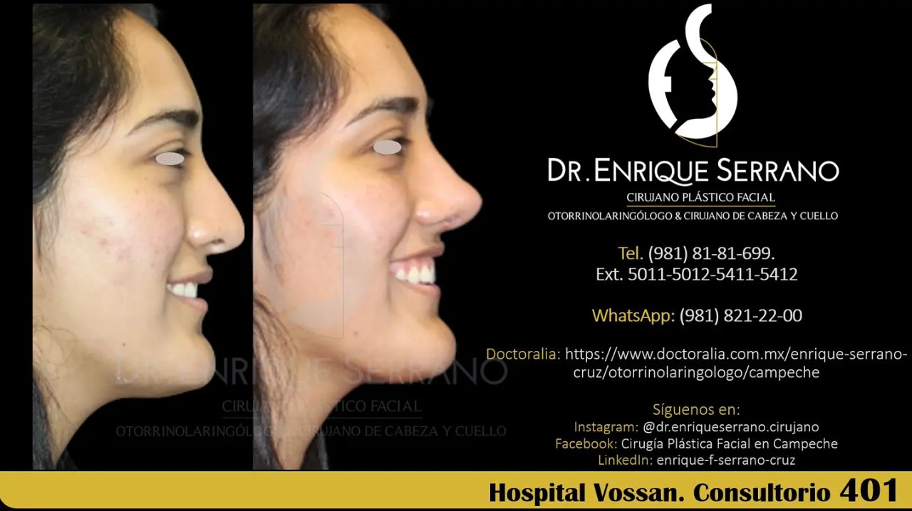 Enrique Serrano Cruz-94