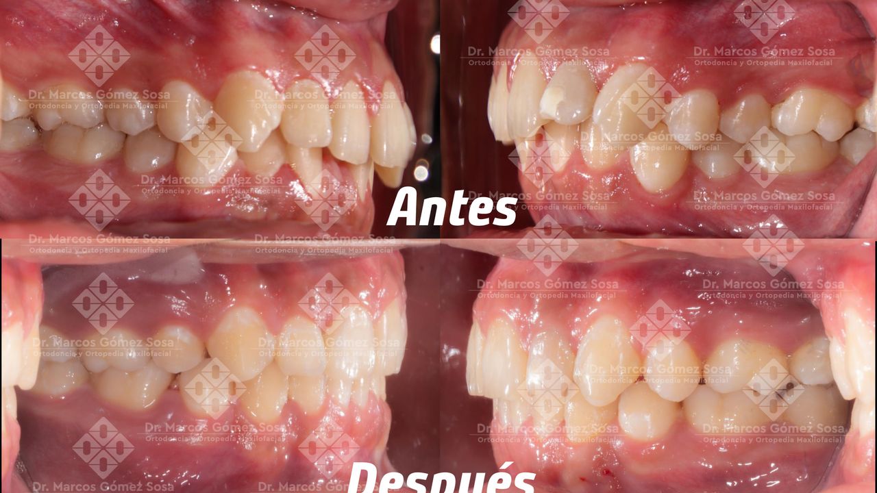 Marcos Gómez Sosa-18