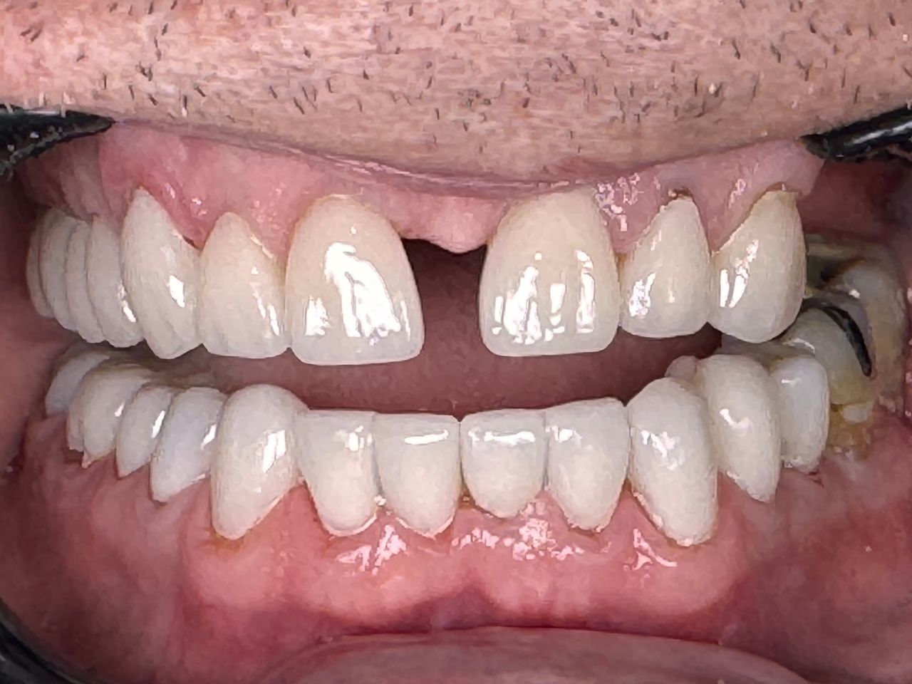 Luis Delgado Carlos-1