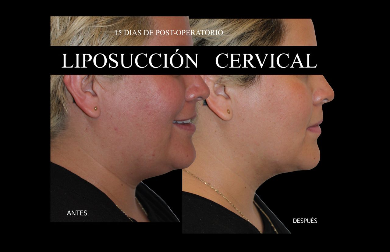 Giovani Ramírez Limón-14