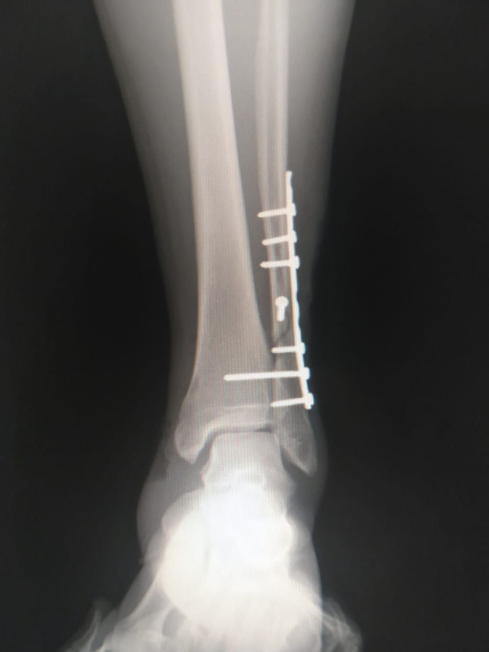 Carlos Alberto Romero Sosa-7