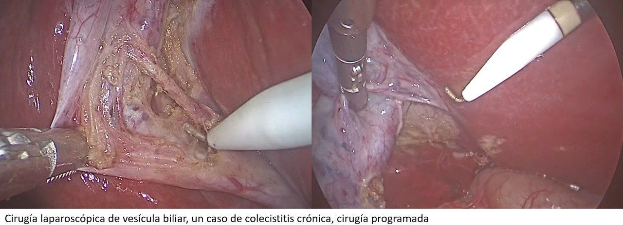 José Miguel Romero De La Vega-2