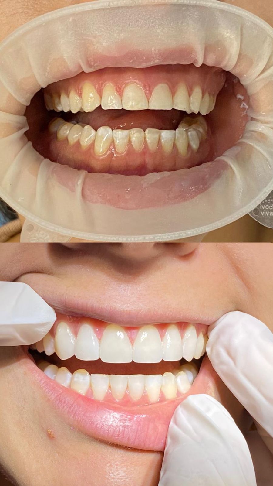 Luz Elena Carrera Luna-1