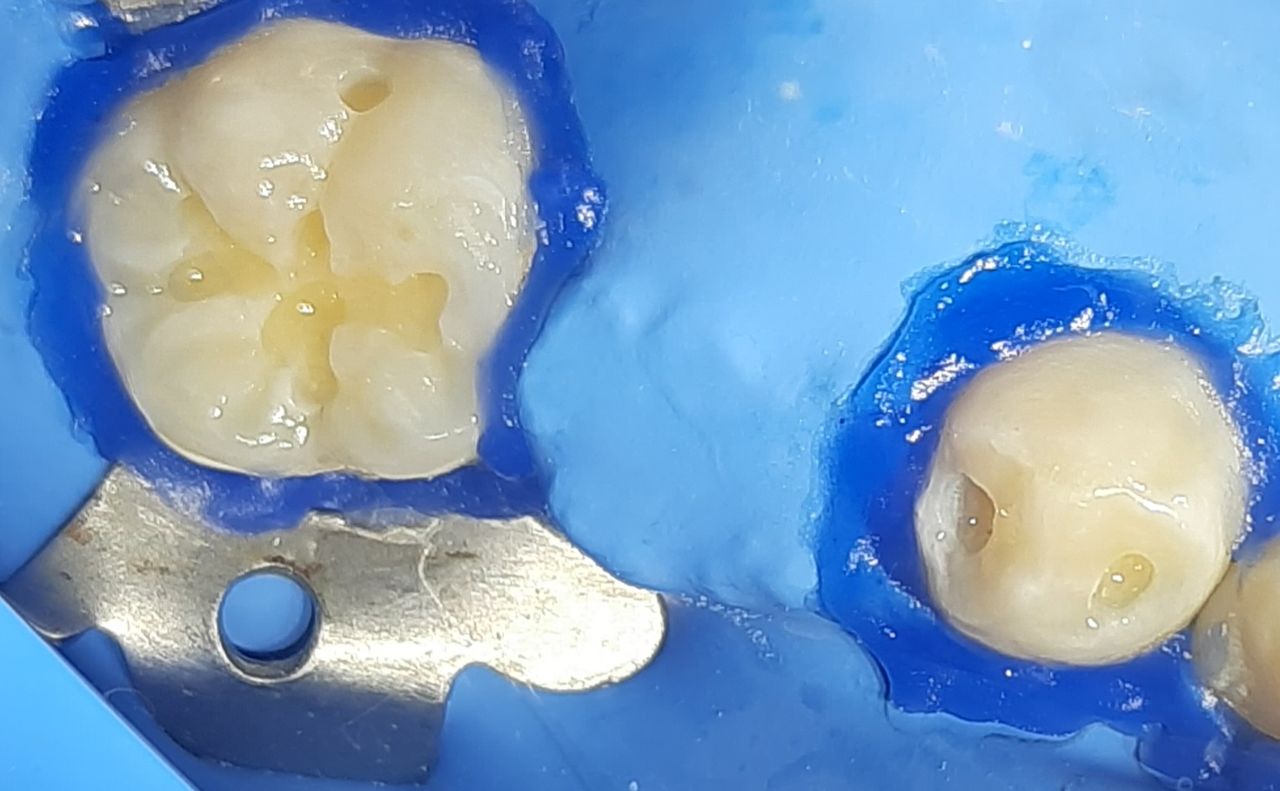 Oscar Justo Bustos-8