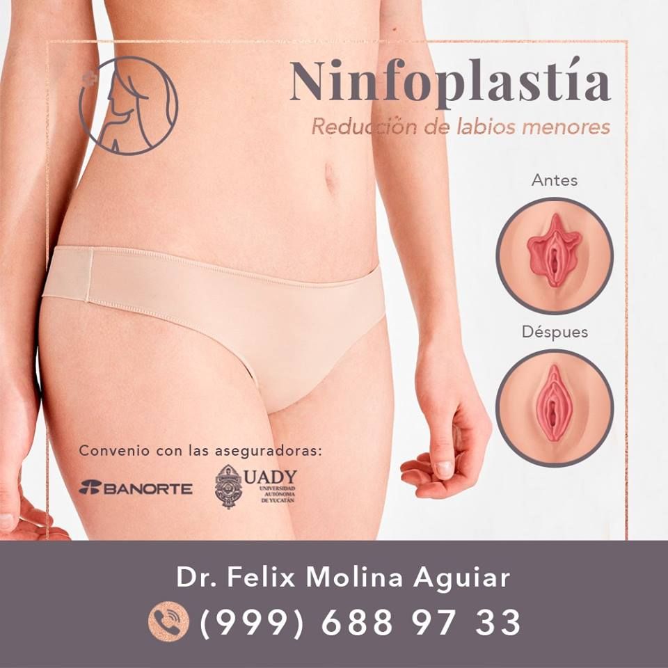 Félix José Molina Aguiar-32