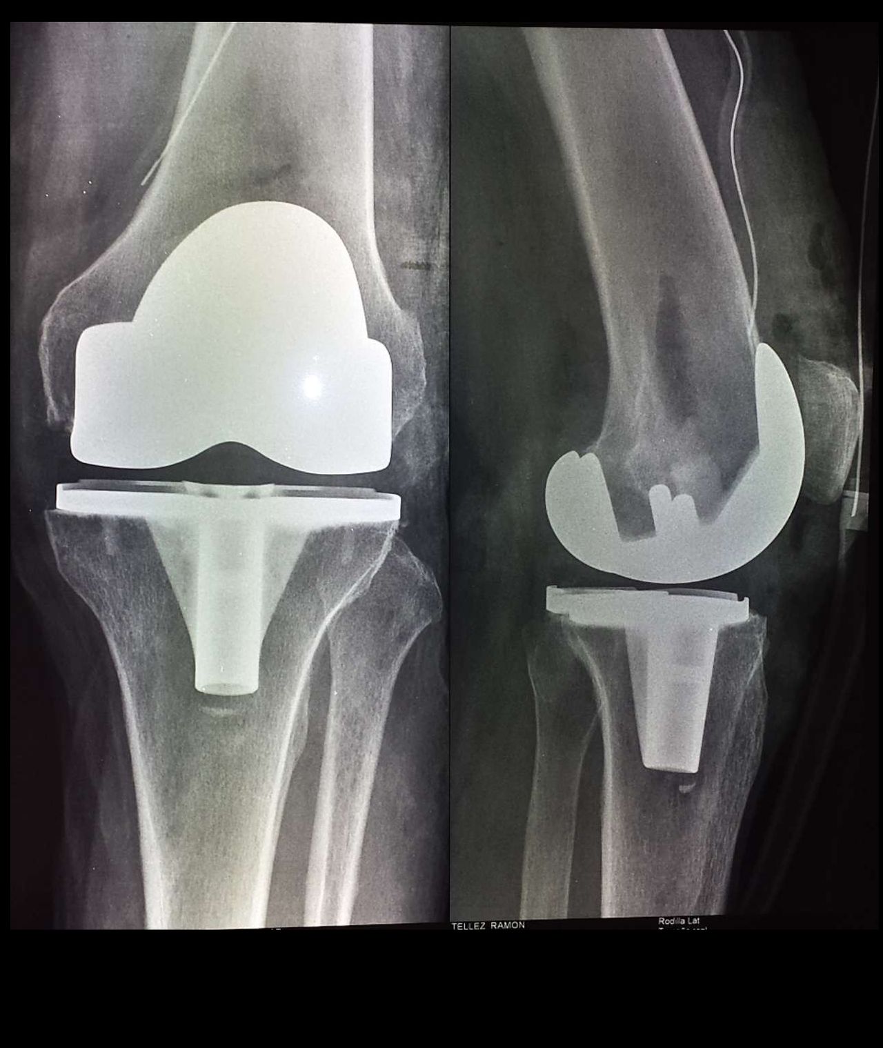 Marco Antonio Altamirano Cruz-10