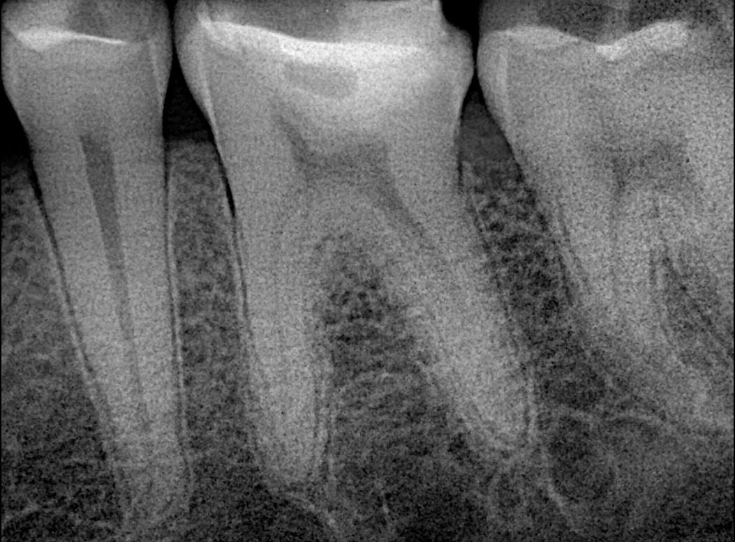 Rocio De La Aurora Carreón Vázquez-15