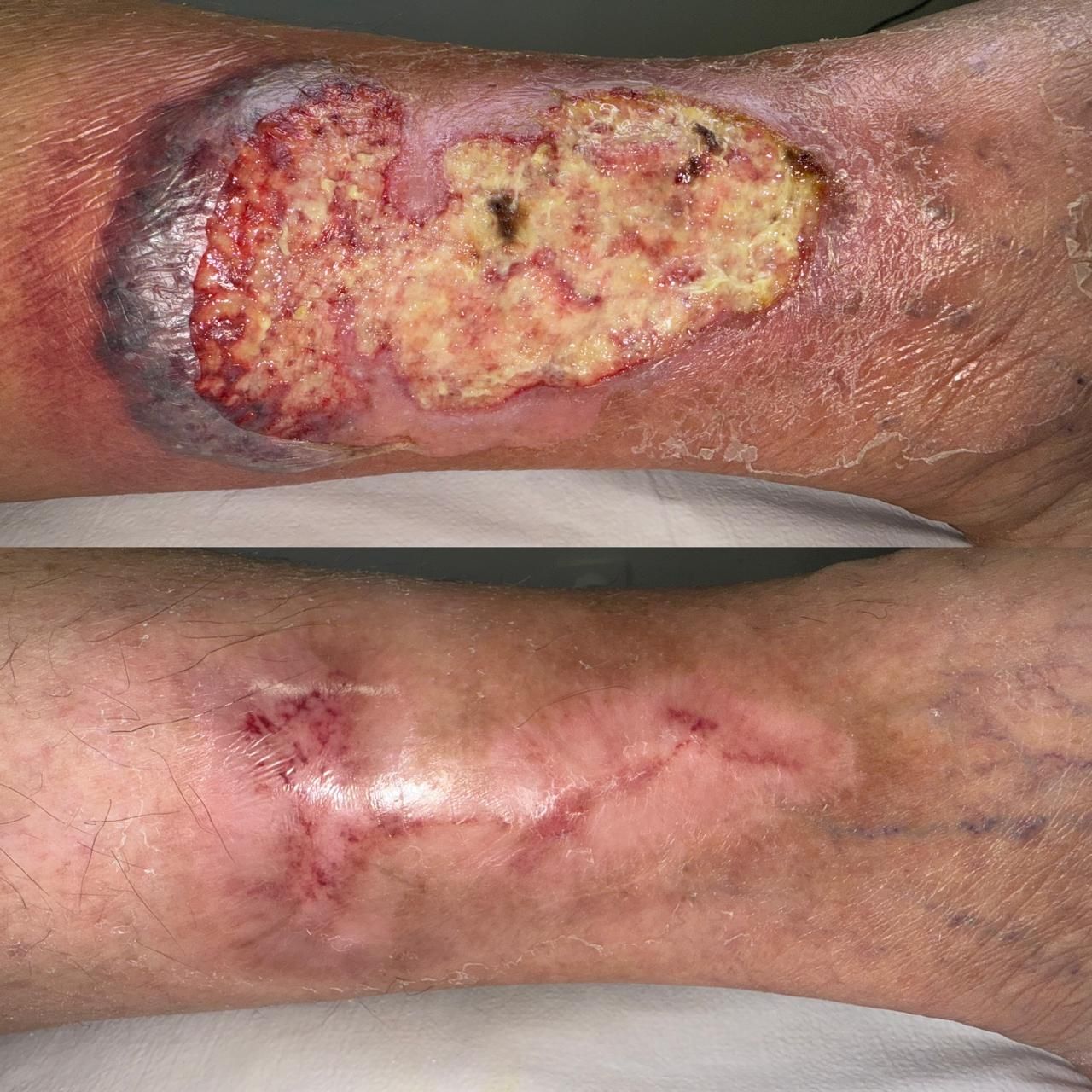 Jhonatan López González-74