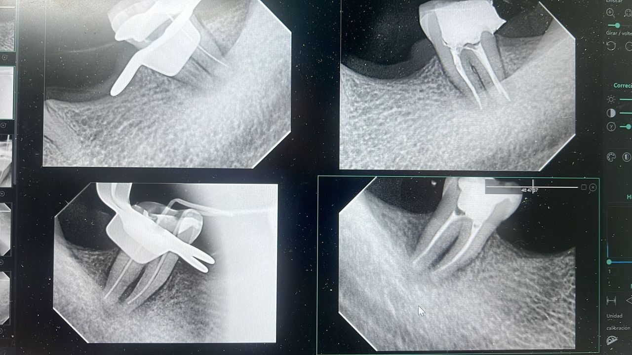 Jair Contreras García-42