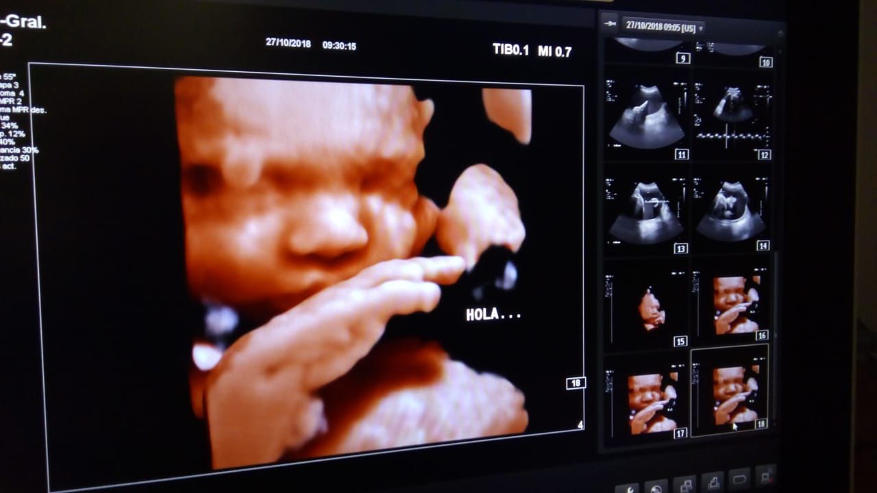 Brenda Anaid Torres Ugalde-7