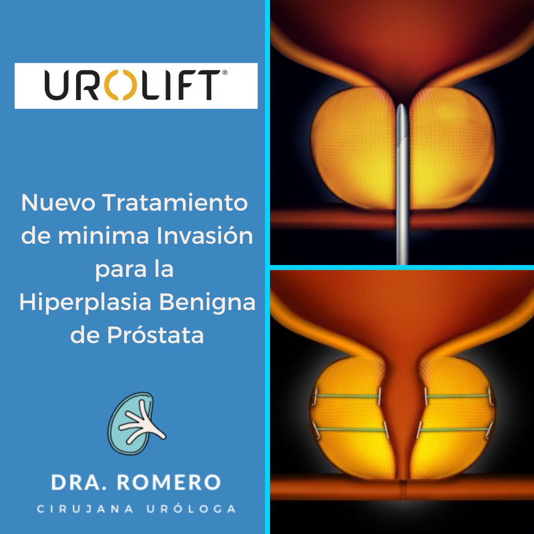 Rosa Estela Romero Aguilar-5