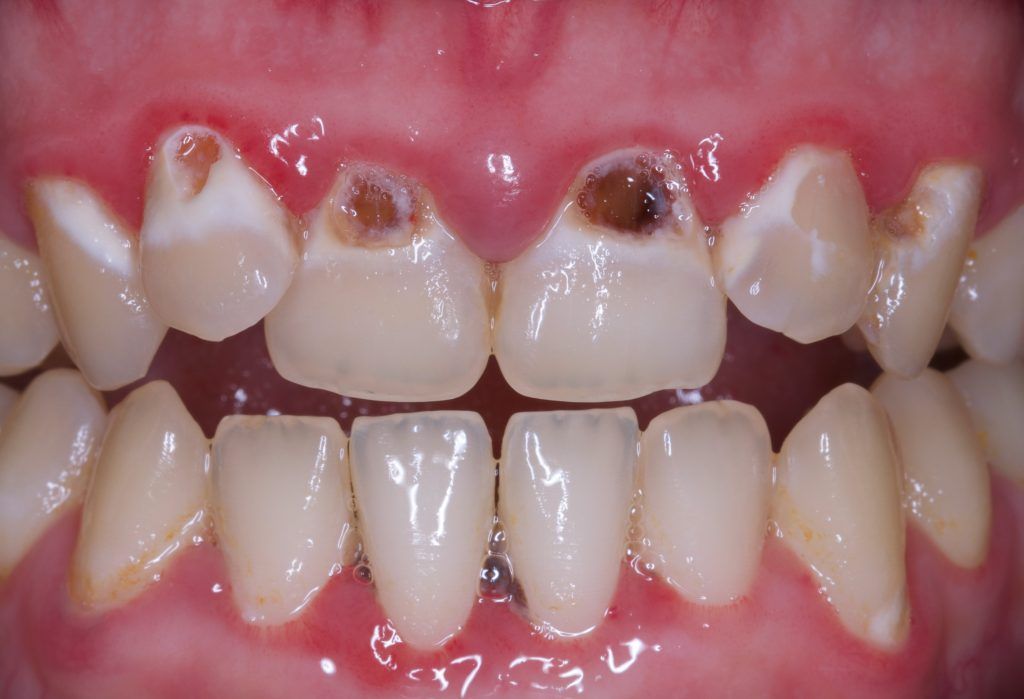 Esmeralda Candida Guerrero Pimentel-33