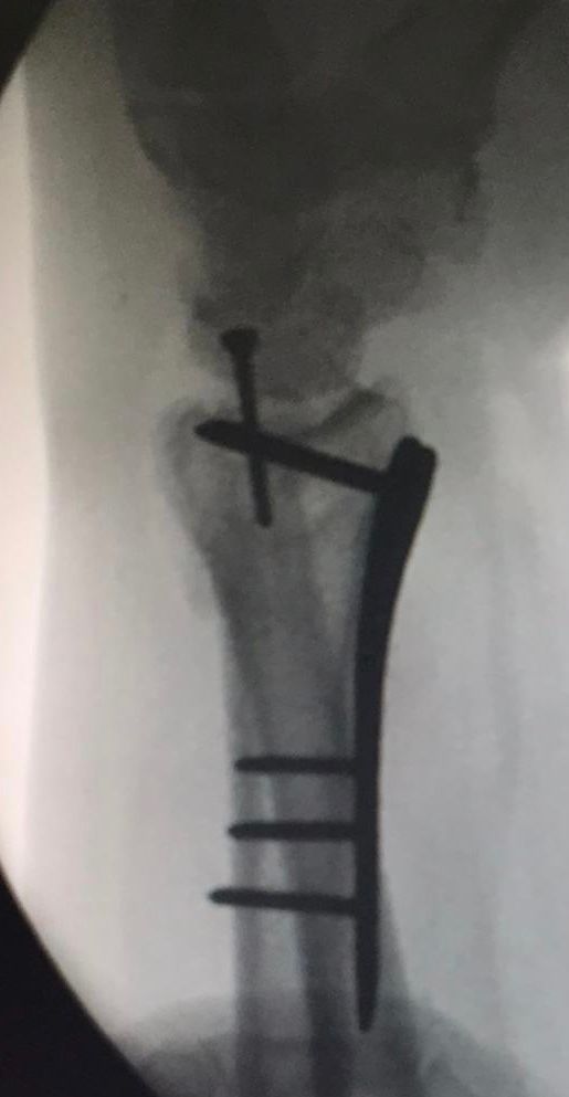 Gabriel Ramírez Lozano-24