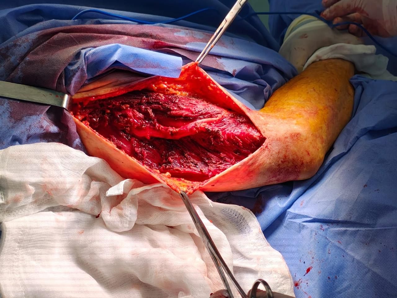 Carlos Arturo Gama Sánchez-3