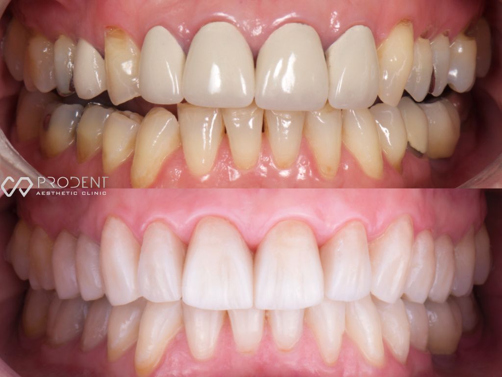 Ulises Pérez Murillo-55