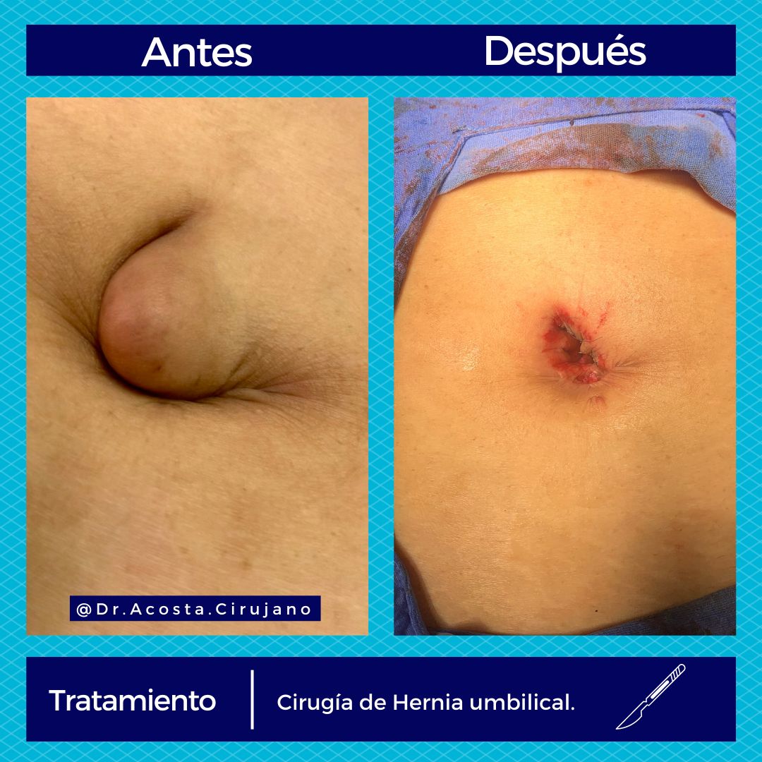 Edgar Raziel Acosta May-9