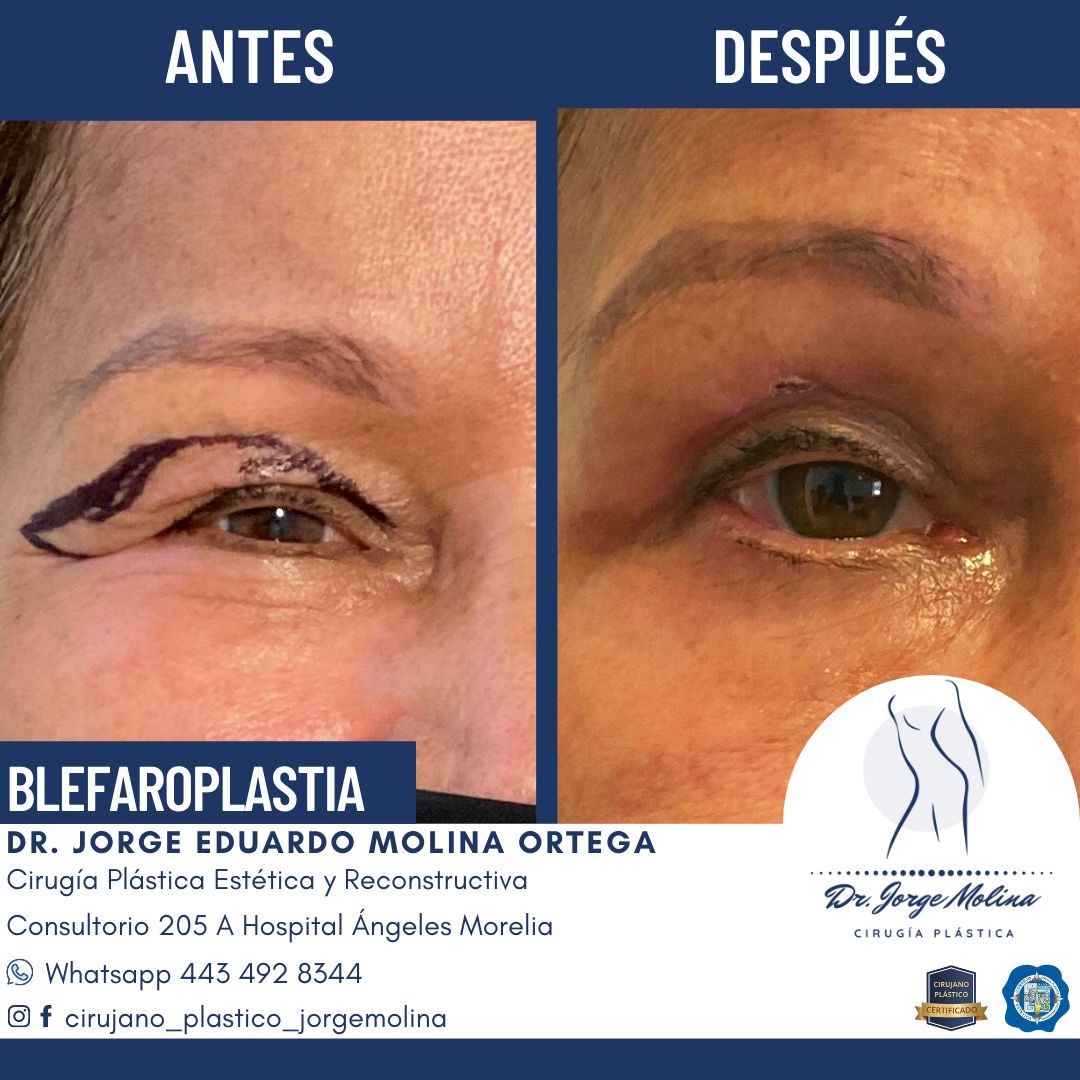 Jorge Eduardo Molina Ortega-3