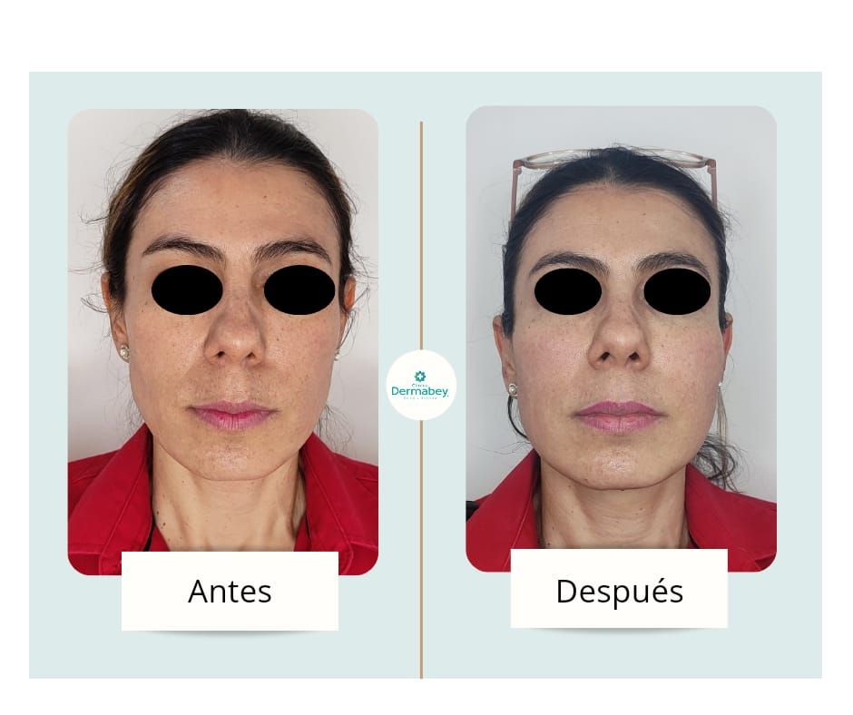 Fenicia Elena Martínez Bey-4