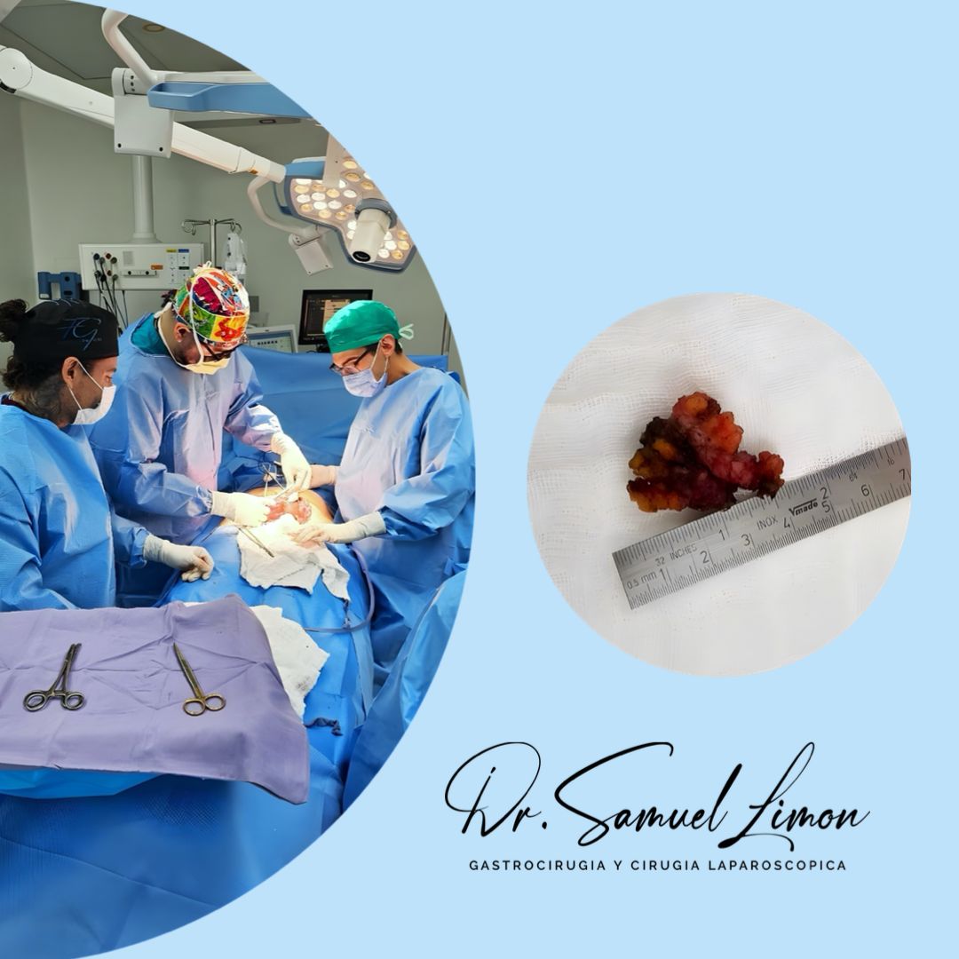 Samuel Limón Suarez-4