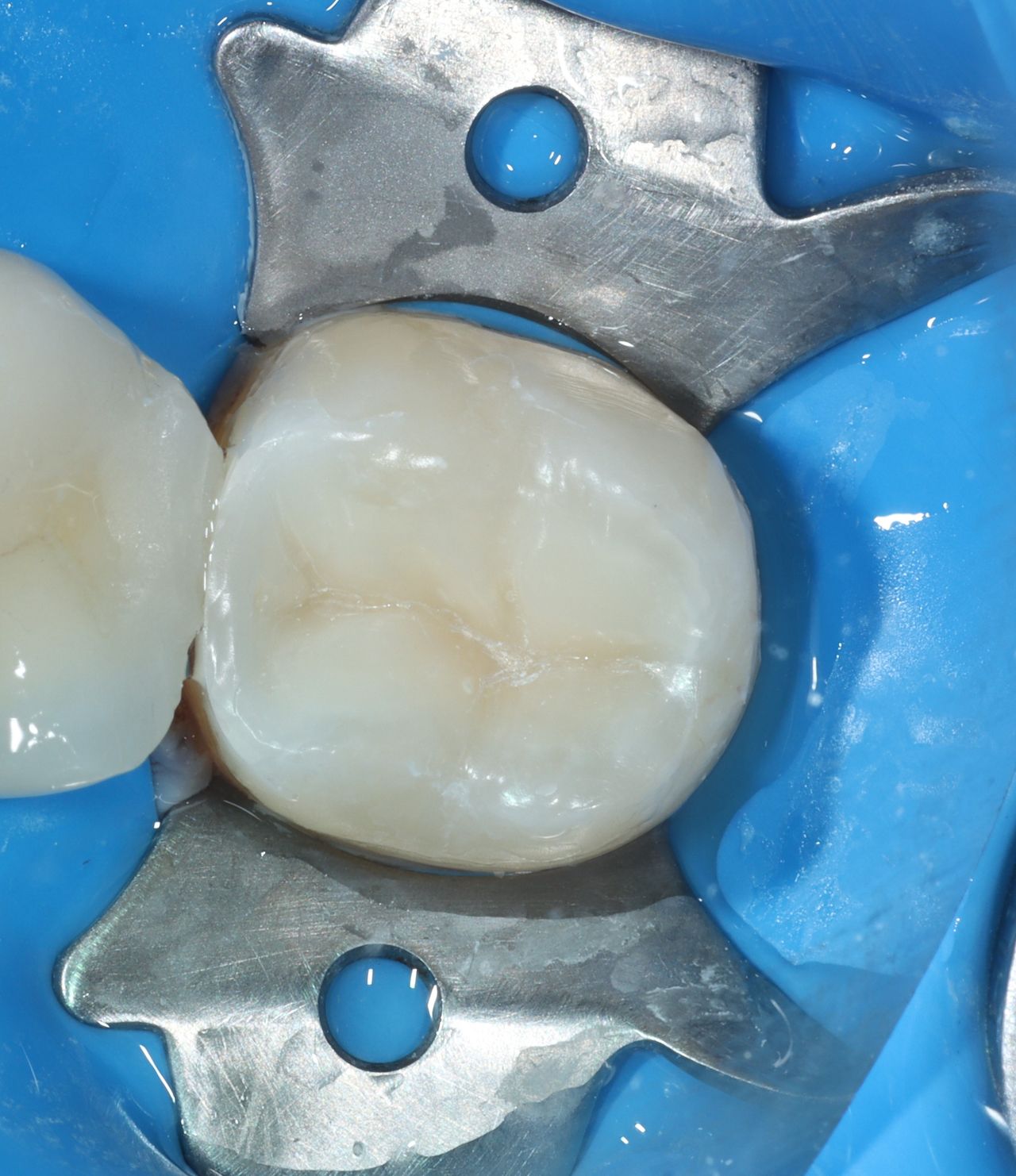 Uiquixu Flores Castro-10