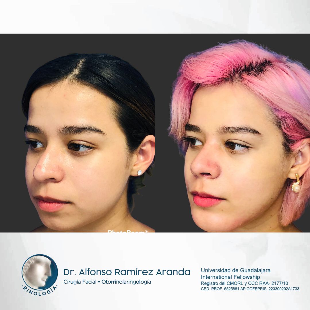 Alfonso Ramírez Aranda-22