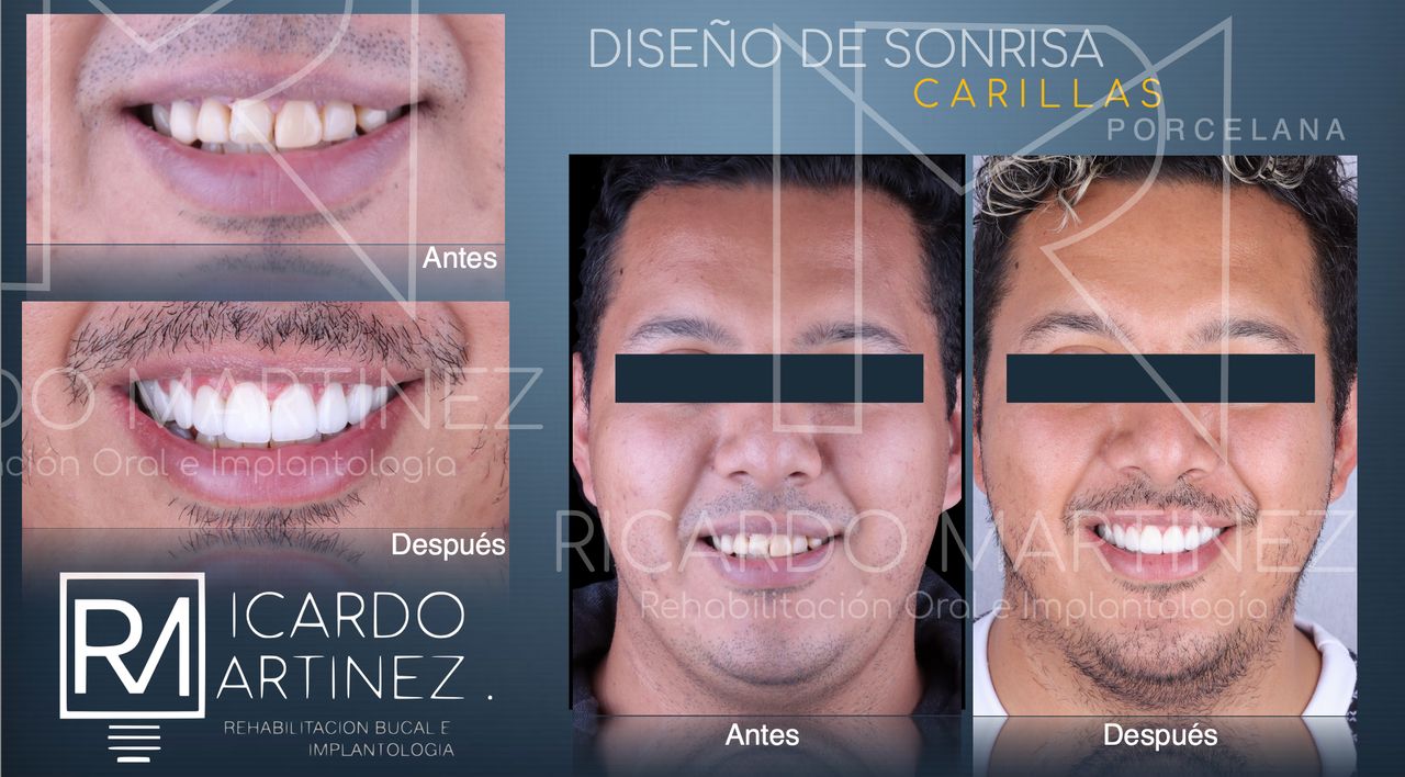 J. Ricardo Martínez-0