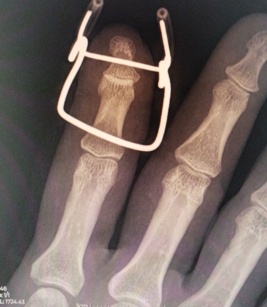 Leonardo Isaac Re-17