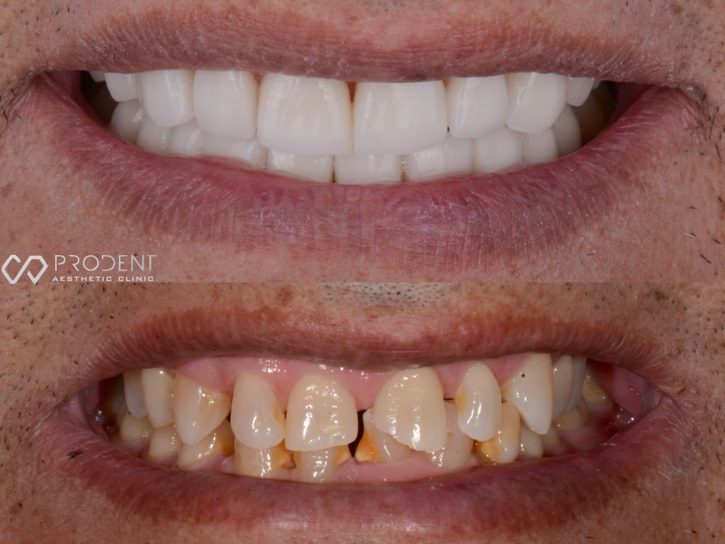 Ulises Pérez Murillo-85