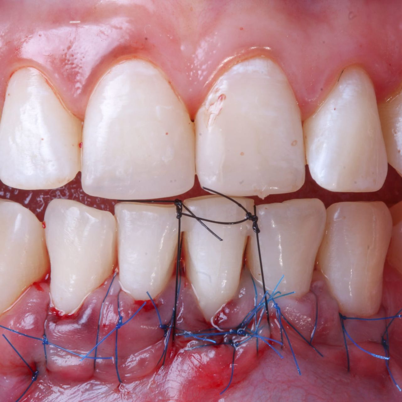 Hugo Enrique Aguilar Lamas-37