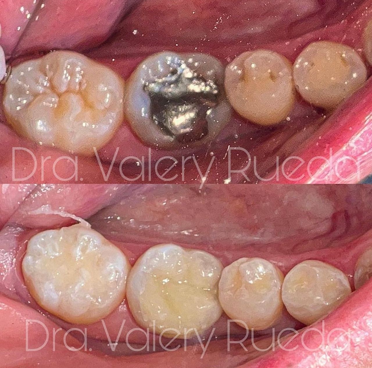 Valery Rueda Mendoza-5