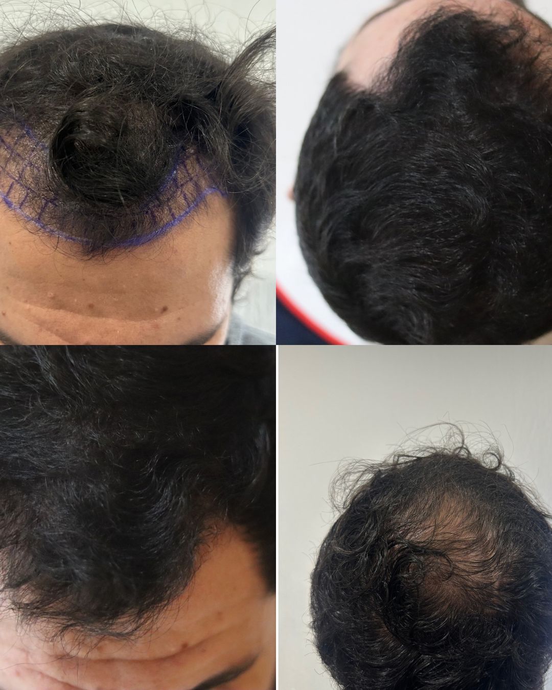 Adrian Hernandez Lopez-21