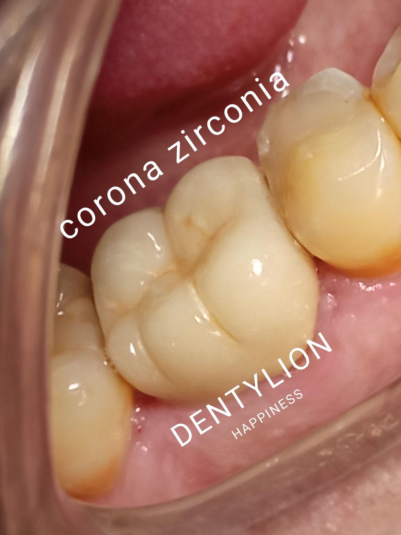 Jessica De La Barrera Valladolid-40