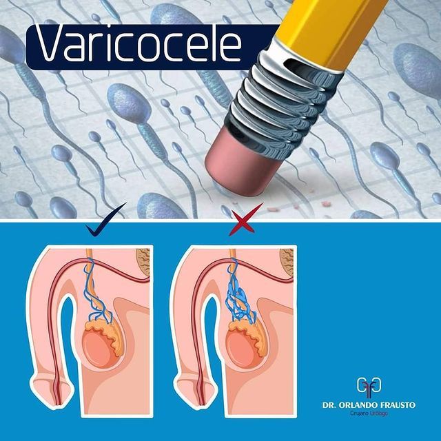 Orlando Frausto Valdes-12