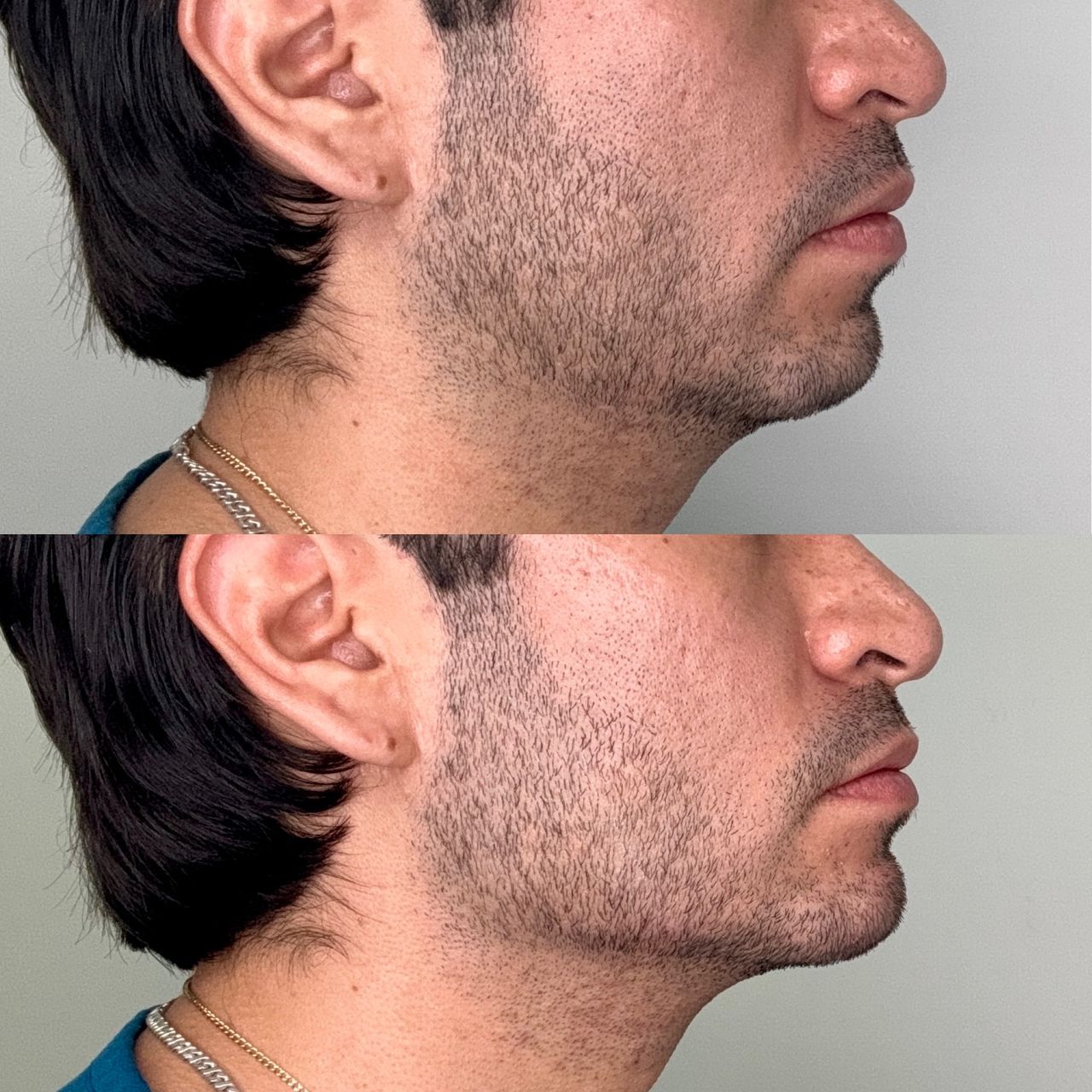 Anuar Hernández Flores-9