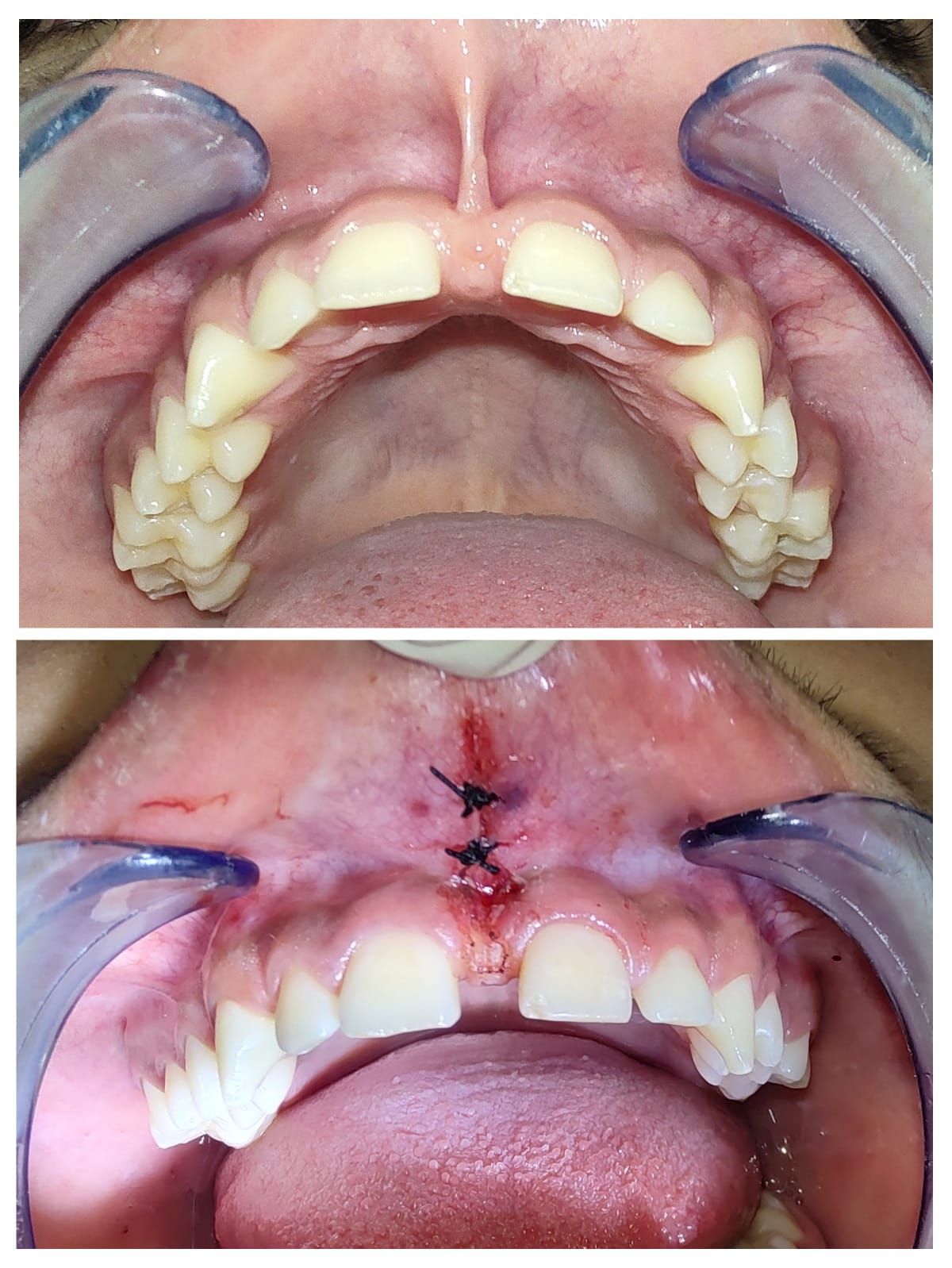 Aimée Quiroz Mendoza-39