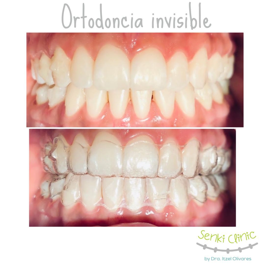 Itzel Olivares Lara-14