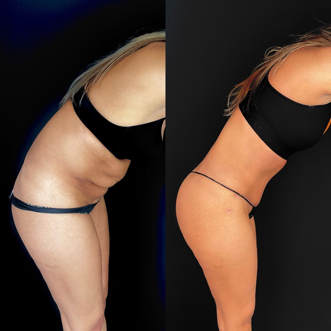 Giuseppe Tanzillo-12