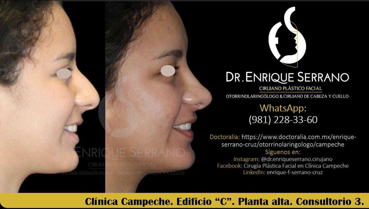 Enrique Serrano Cruz-70