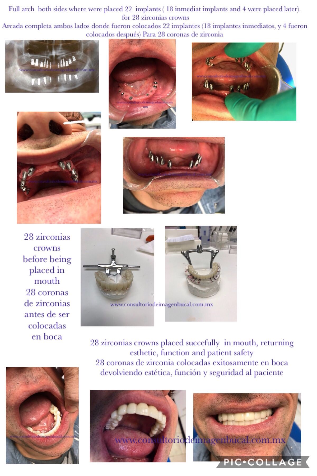 Alfonso Gonzalez Ocaranza-13