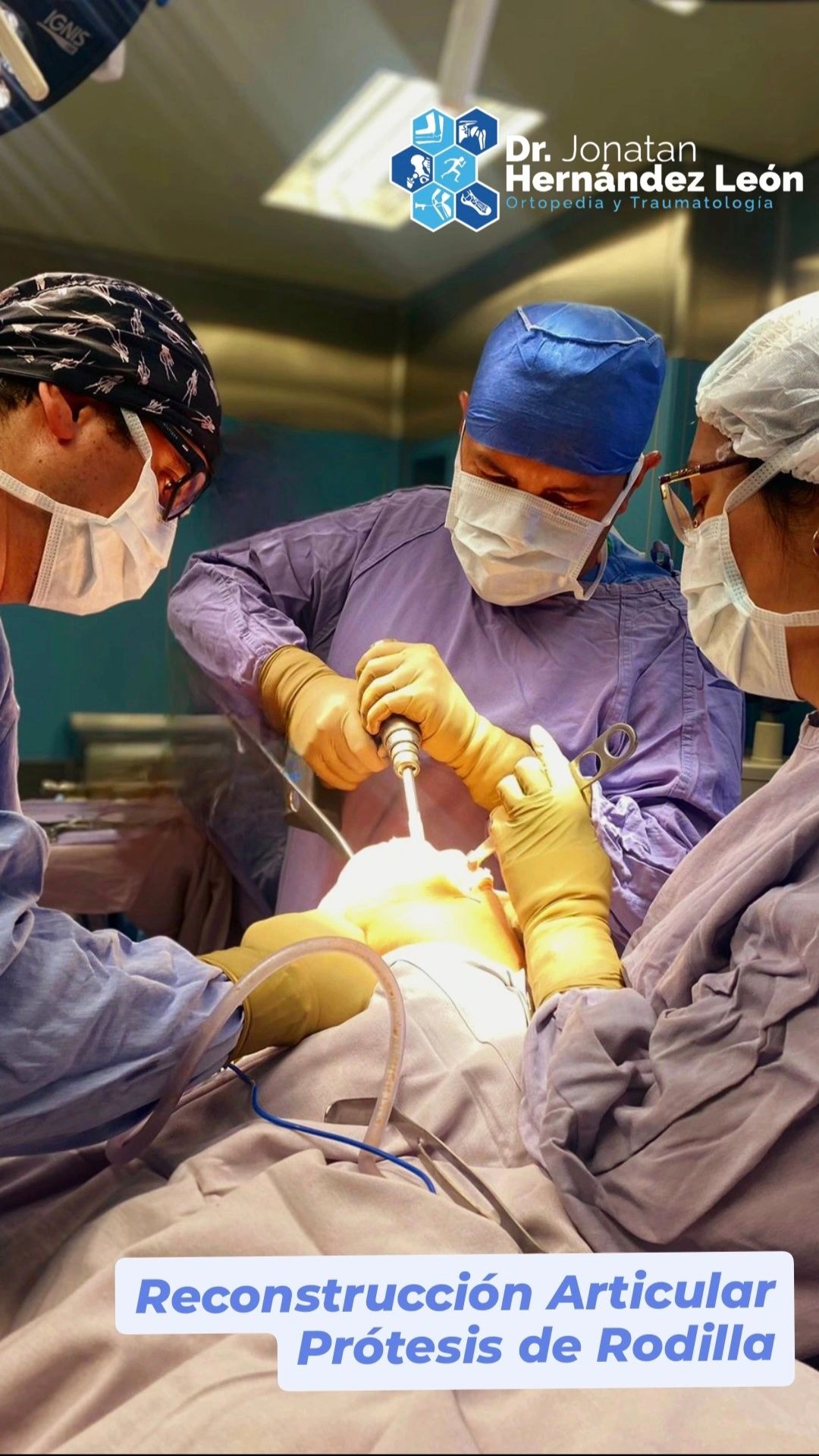 Jonatan Hernández León-26