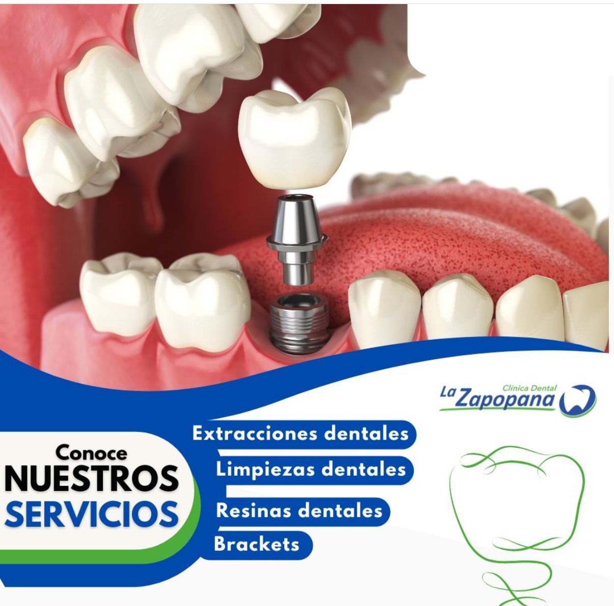 Crisanto Alonso Tepox-2