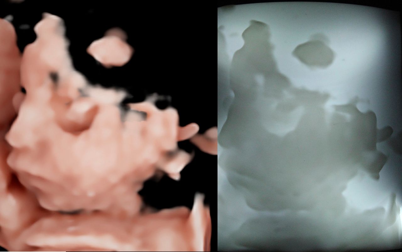 Raul Alejandro Patlan Montalvo-6