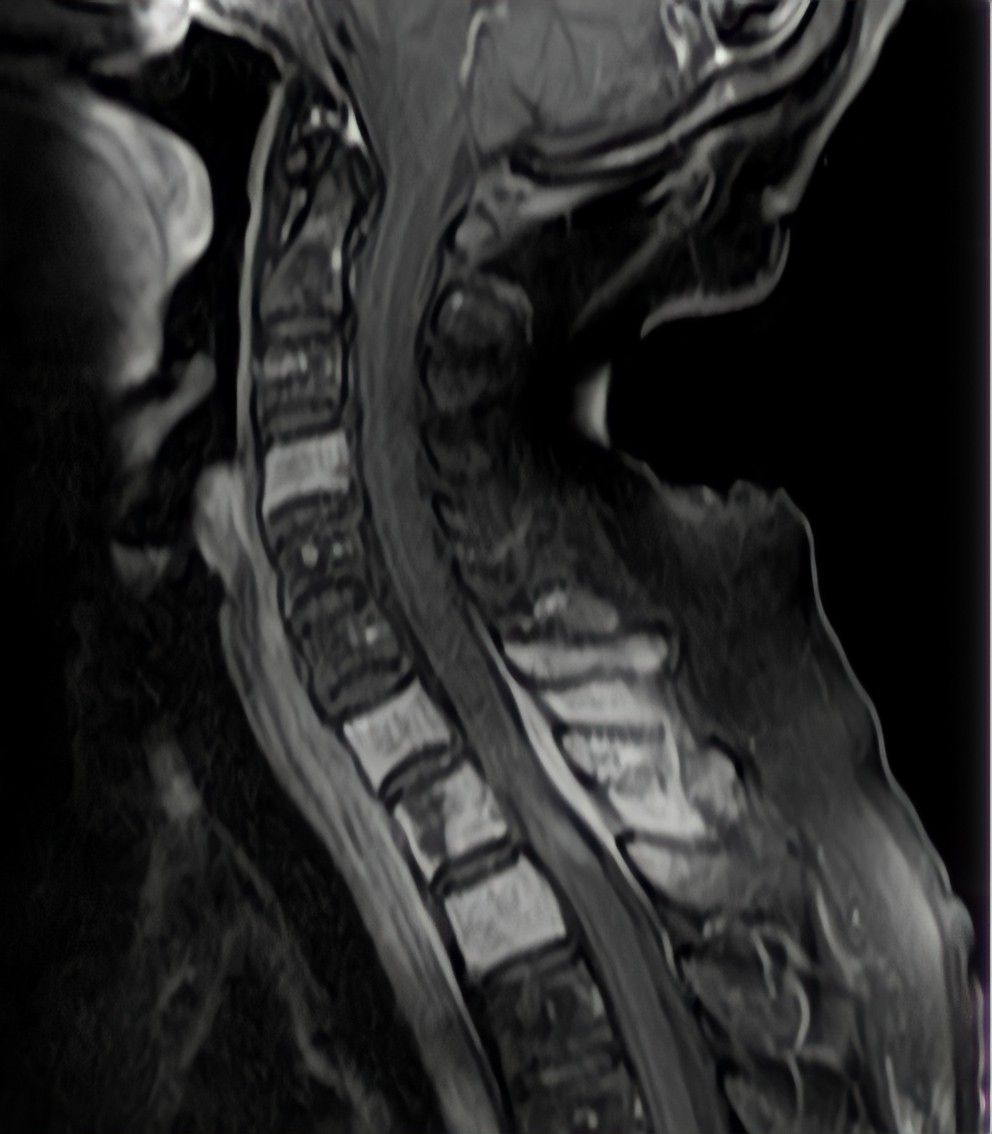 Gilraed Mota García-9