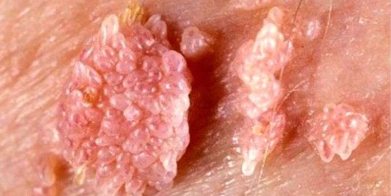 Pilar Arroyo Tenorio-4