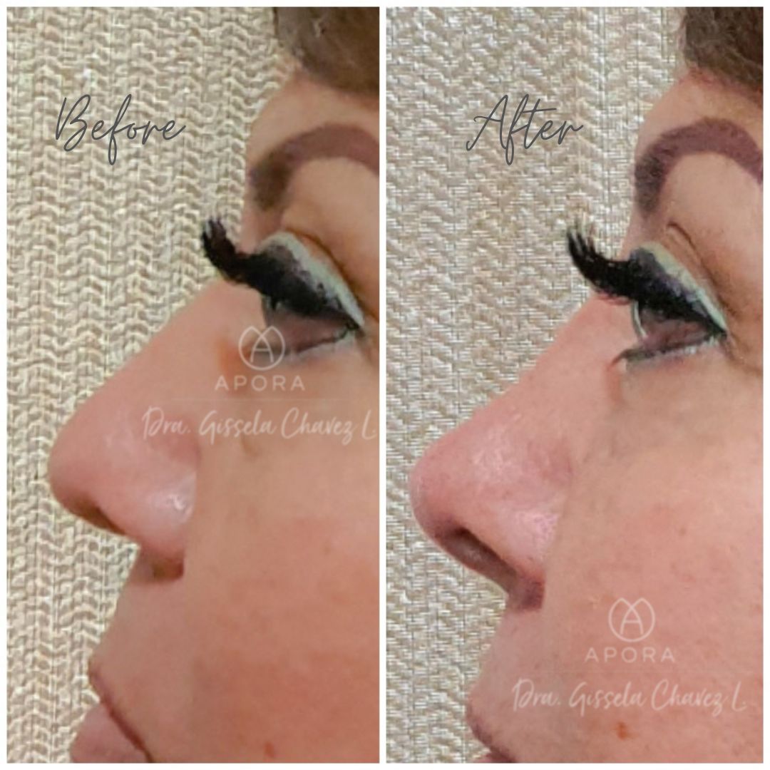 Gissela Chávez Lizardi-12